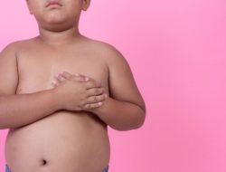 Cara Mengetahui Anak Obesitas atau Tidak