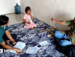 Hasil visum korban penganiayaan ibu tiri di Sukabumi, kondisi memprihatinkan